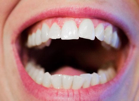 Tips for Healthy Teeth and Gums