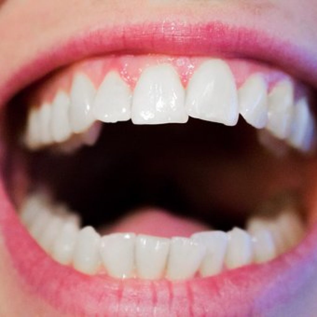 List 100+ Images picture of healthy gums and teeth Full HD, 2k, 4k