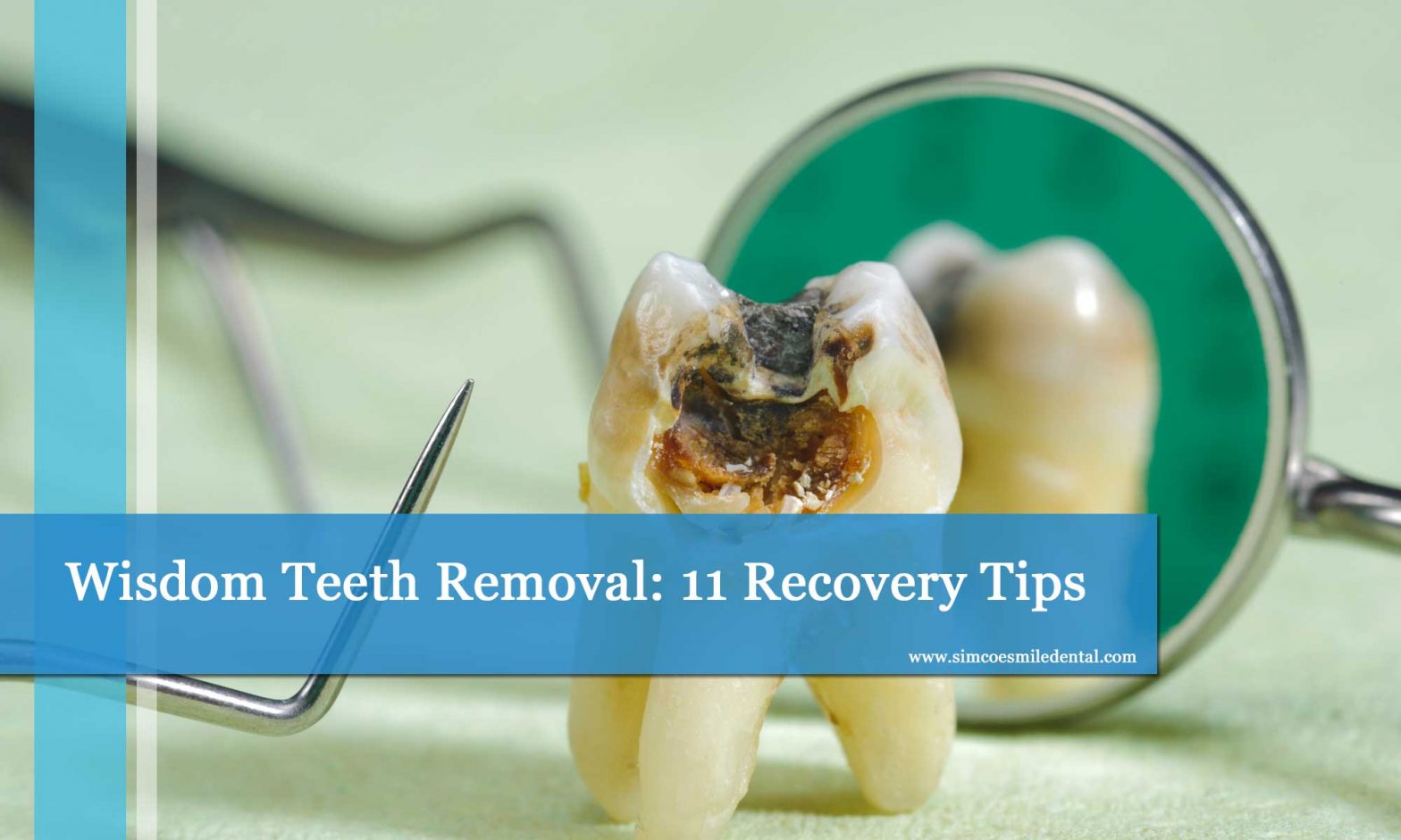 Wisdom Teeth Removal: 11 Recovery Tips