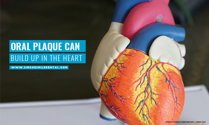Oral plaque can build up in the heart