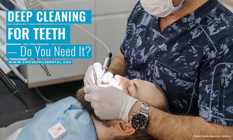 Deep Cleaning for Teeth — Do You Need It? Simcoe Smile Dental
