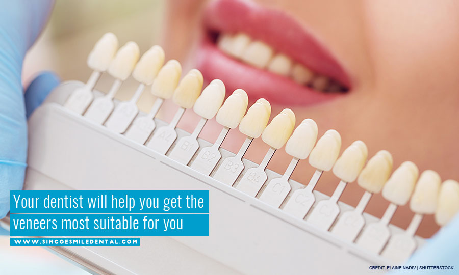 Your dentist will help you get the veneers most suitable for you