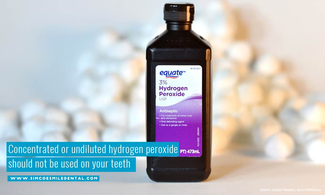 Concentrated or undiluted hydrogen peroxide should not be used on your teeth