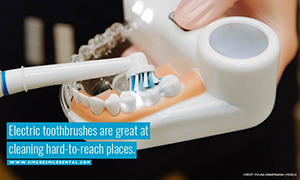 Electric toothbrushes are great at cleaning hard-to-reach places.