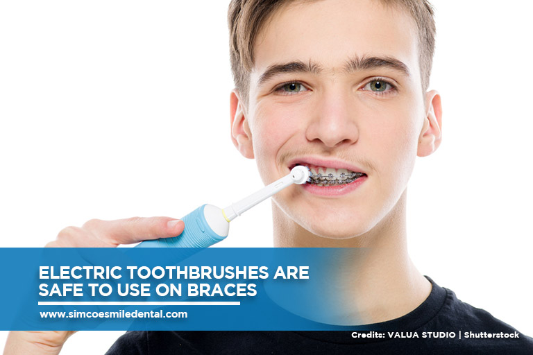 Electric toothbrushes are safe to use on braces