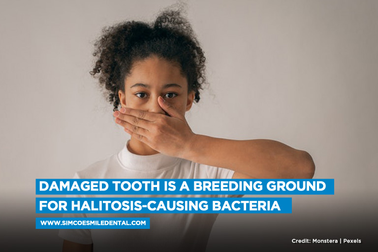 Damaged tooth is a breeding ground for halitosis-causing bacteria