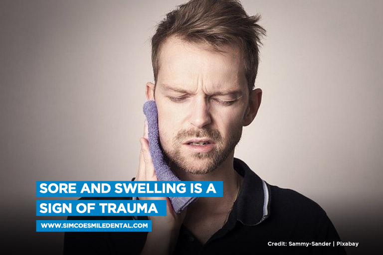Sore and swelling is a sign of trauma