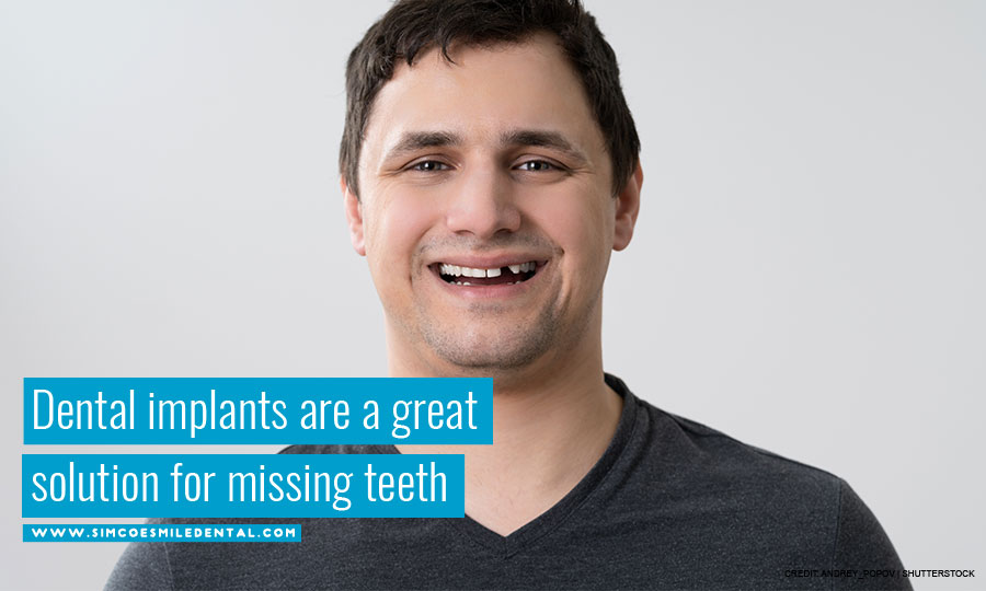 Dental implants are a great solution for missing teeth
