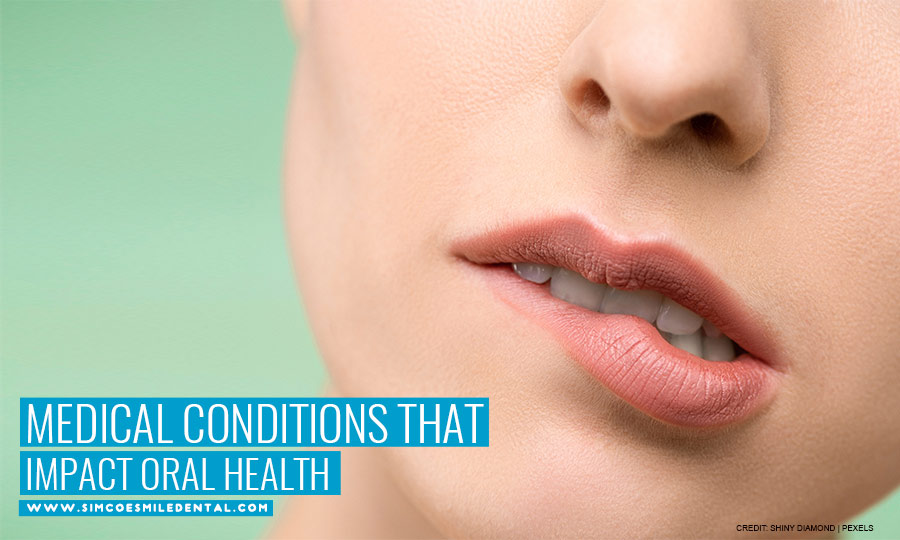 Medical Conditions That Impact Oral Health
