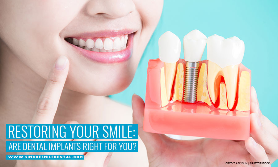 Restoring Your Smile: Are Dental Implants Right for You?
