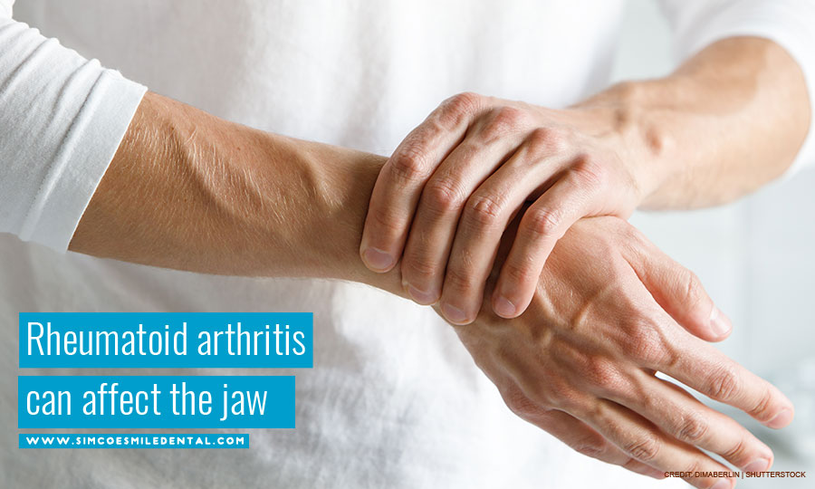 Rheumatoid arthritis can affect the jaw