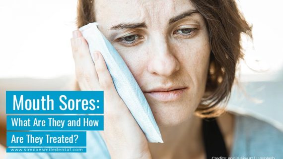 Mouth Sores: What Are They and How Are They Treated?